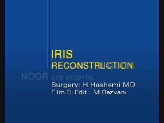 نفر اول جشنواره - Iris Reconstruction